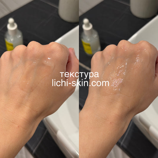 Сироватка від постакне Acnemy Postzit Post Breakout Treatment, 30 ml