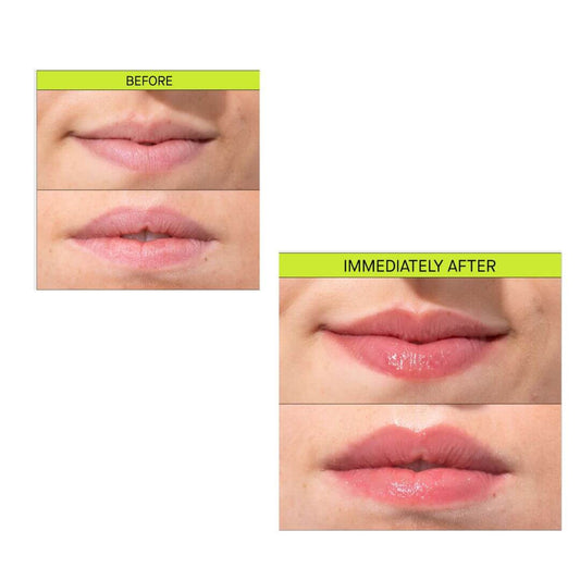 Засіб для ефекту збільшення губ Transparent-Lab Volume Hydro Plump Lip Augmentation, 15 ml