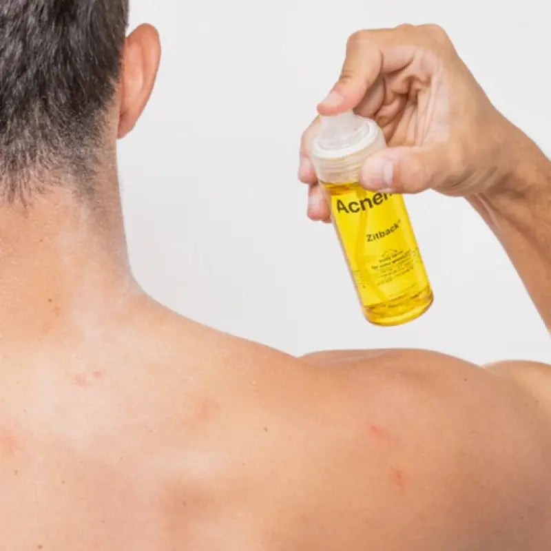 Спрей для тіла з акне Acnemy ZITBACK, 80 ml